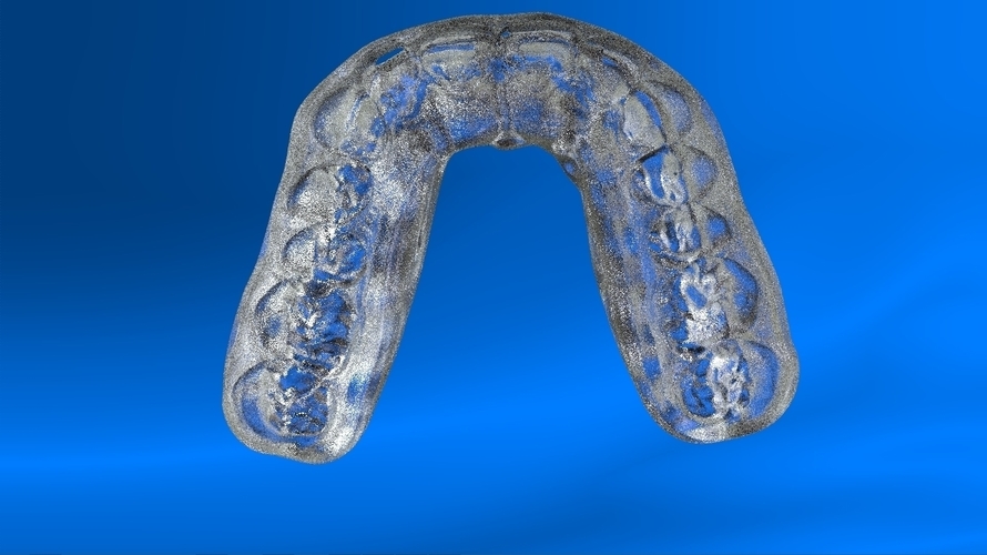 Digital Tooth Positioner 3D Print 159626 Digital Tooth Positioner 3D Print 159626