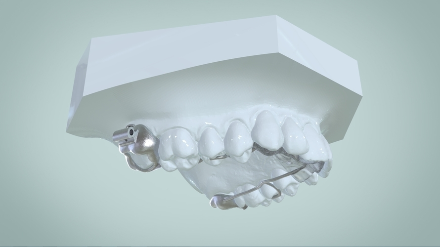 Digital Ortho Rick-a-Nator Appliance 3D Print 159628 Digital Ortho Rick-a-Nator Appliance 3D Print 159628