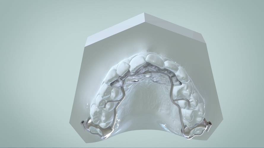 Digital Ortho Rick-a-Nator Appliance 3D Print 159629 Digital Ortho Rick-a-Nator Appliance 3D Print 159629