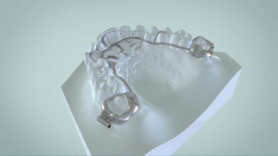 Digital Ortho Rick-a-Nator Appliance 3D Print 159630 Digital Ortho Rick-a-Nator Appliance 3D Print 159630