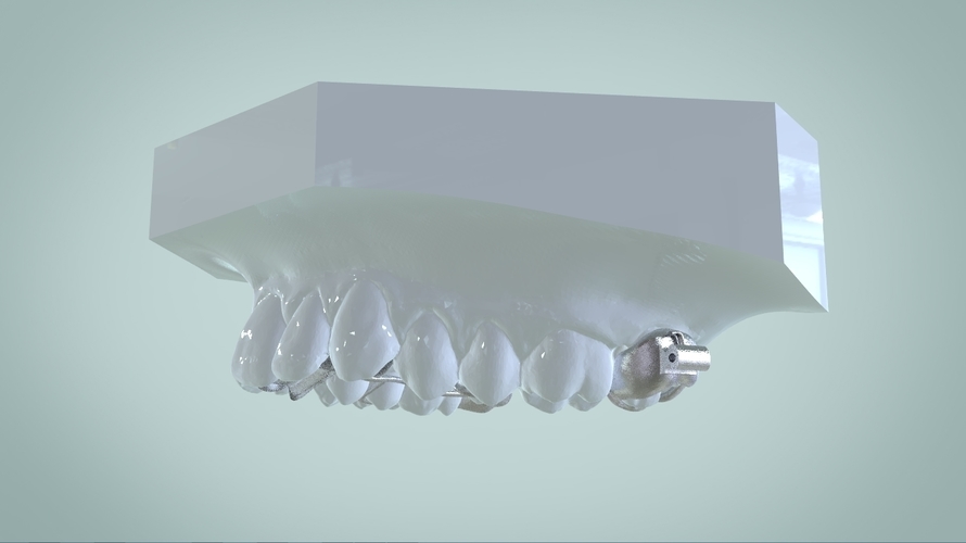 Digital Ortho Rick-a-Nator Appliance 3D Print 159631 Digital Ortho Rick-a-Nator Appliance 3D Print 159631