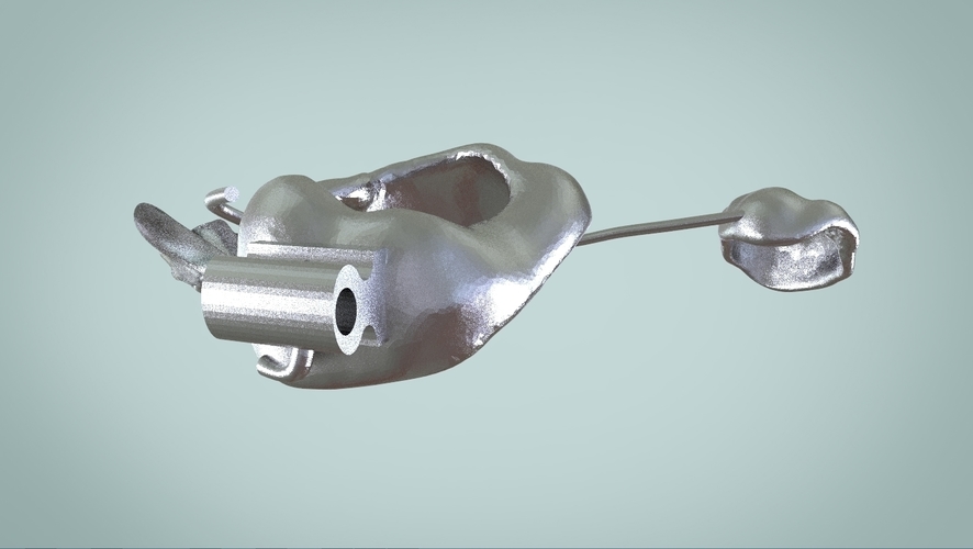 Digital Ortho Rick-a-Nator Appliance 3D Print 159635 Digital Ortho Rick-a-Nator Appliance 3D Print 159635