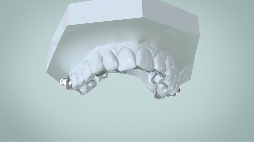 Digital Ortho Rick-a-Nator Appliance 3D Print 159637 Digital Ortho Rick-a-Nator Appliance 3D Print 159637