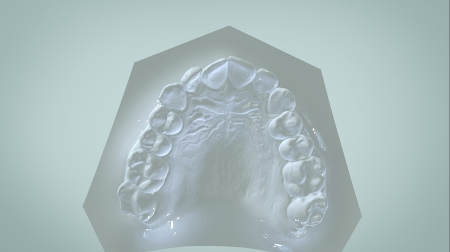 Digital Ortho Rick-a-Nator Appliance 3D Print 159638 Digital Ortho Rick-a-Nator Appliance 3D Print 159638