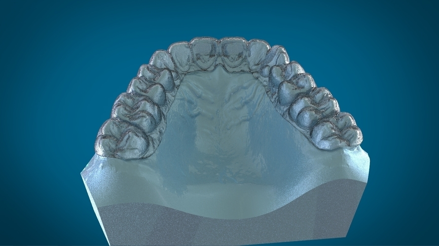 Digital Dental Dayguard Splint 3D Print 159682 Digital Dental Dayguard Splint 3D Print 159682