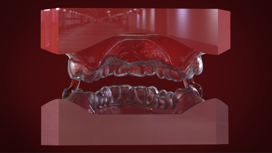 Digital Sleep Apnea Mouthguard 3D Print 159853 Digital Sleep Apnea Mouthguard 3D Print 159853