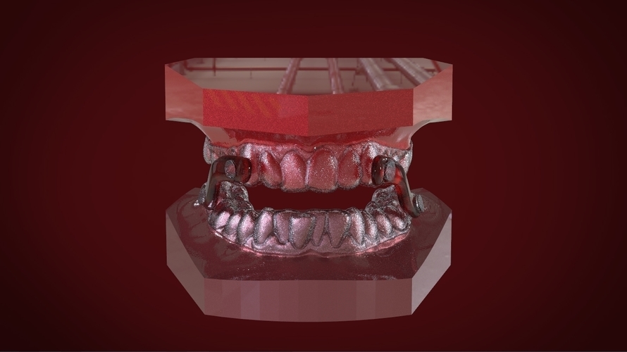 Digital Sleep Apnea Mouthguard 3D Print 159855 Digital Sleep Apnea Mouthguard 3D Print 159855