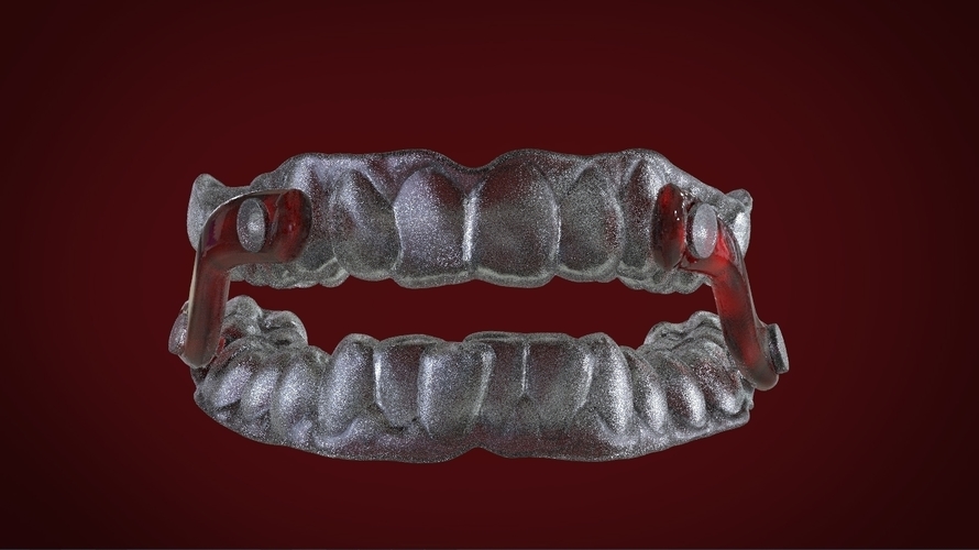 Digital Sleep Apnea Mouthguard 3D Print 159856 Digital Sleep Apnea Mouthguard 3D Print 159856