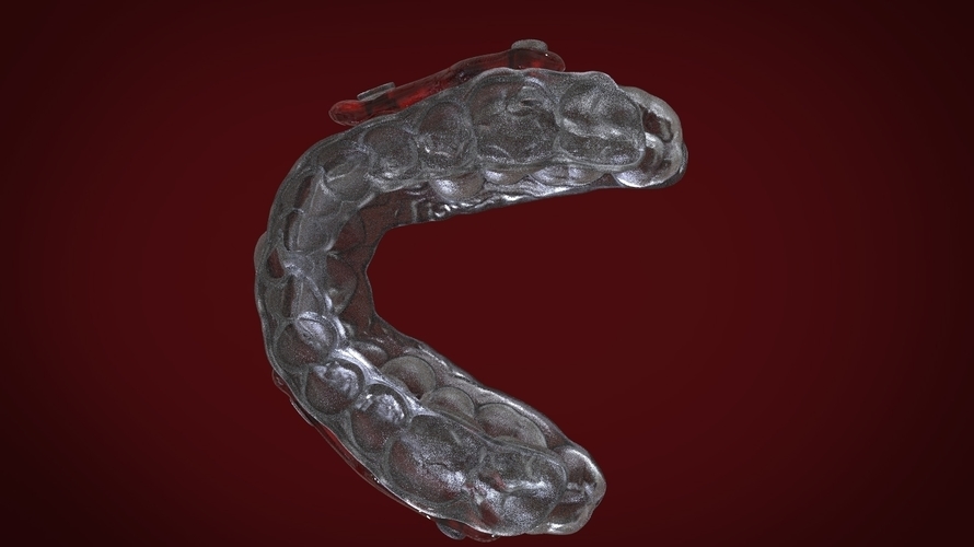 Digital Sleep Apnea Mouthguard 3D Print 159857 Digital Sleep Apnea Mouthguard 3D Print 159857