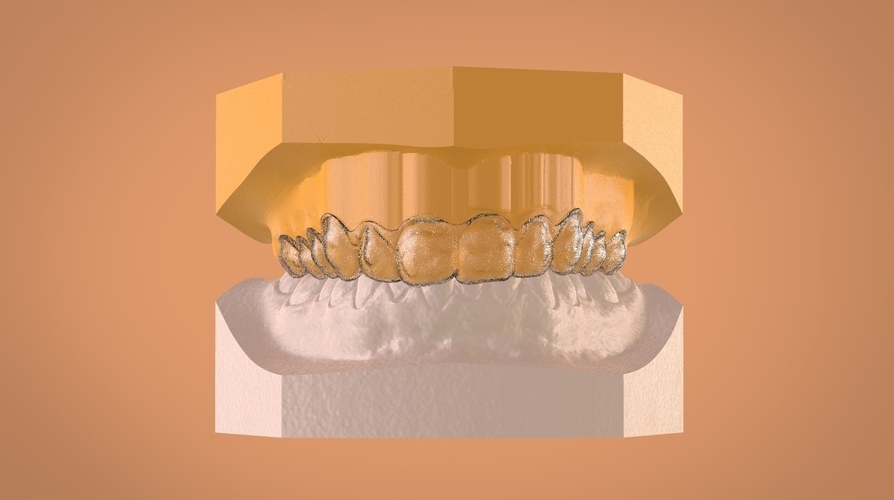 Digital Dental Bleaching Tray 3D Print 160356 Digital Dental Bleaching Tray 3D Print 160356