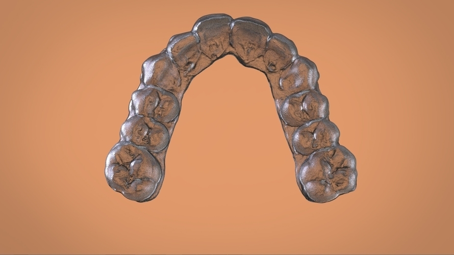 Digital Dental Bleaching Tray 3D Print 160360 Digital Dental Bleaching Tray 3D Print 160360
