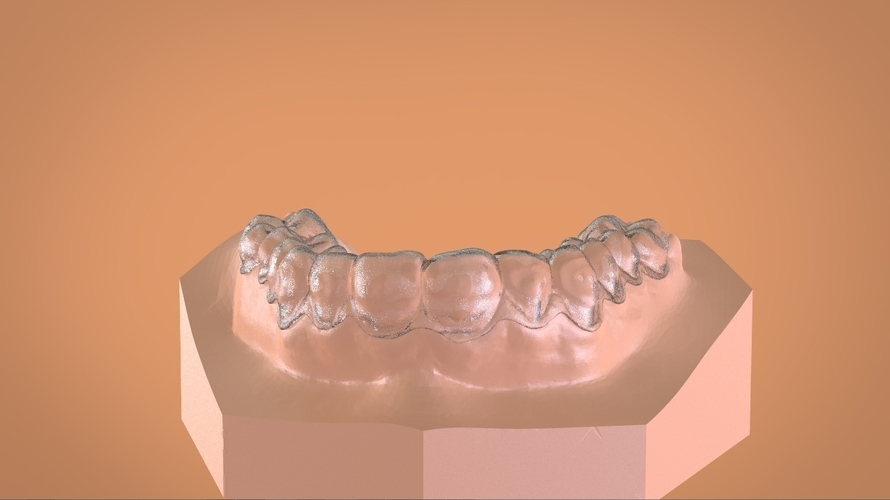 Digital Dental Bleaching Tray 3D Print 160366 Digital Dental Bleaching Tray 3D Print 160366