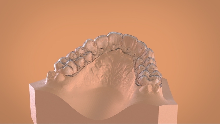 Digital Dental Bleaching Tray 3D Print 160367 Digital Dental Bleaching Tray 3D Print 160367