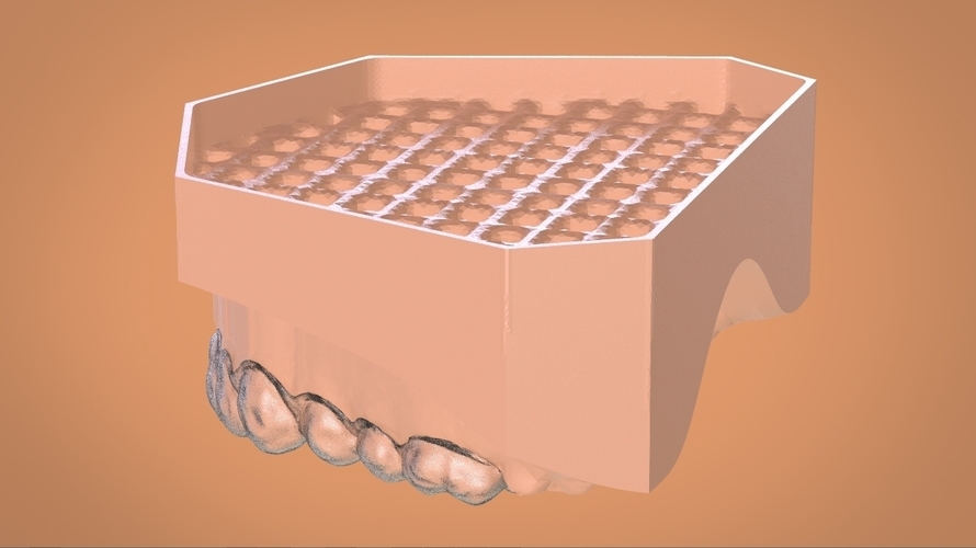 Digital Dental Bleaching Tray 3D Print 160369 Digital Dental Bleaching Tray 3D Print 160369