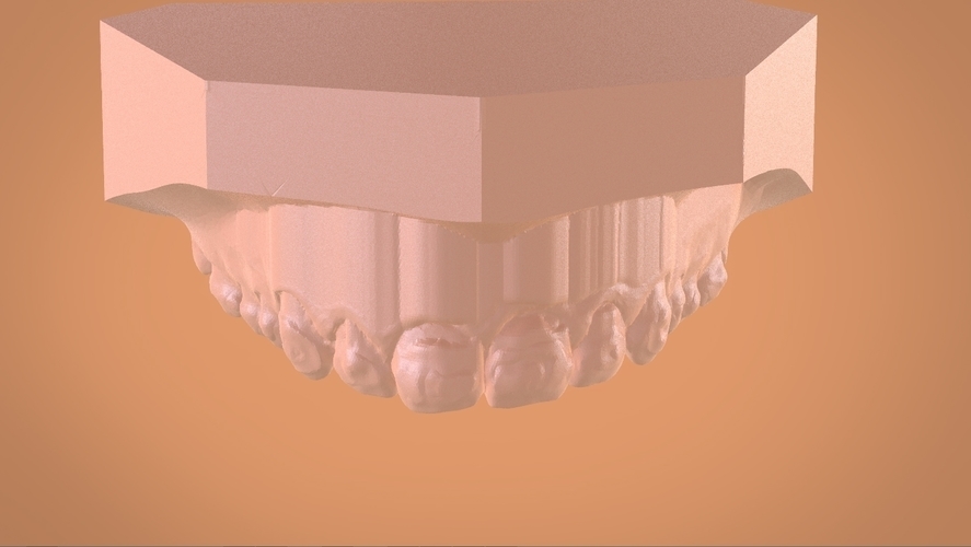 Digital Dental Bleaching Tray 3D Print 160372 Digital Dental Bleaching Tray 3D Print 160372