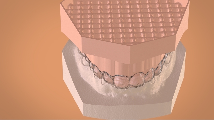 Digital Dental Bleaching Tray 3D Print 160373 Digital Dental Bleaching Tray 3D Print 160373