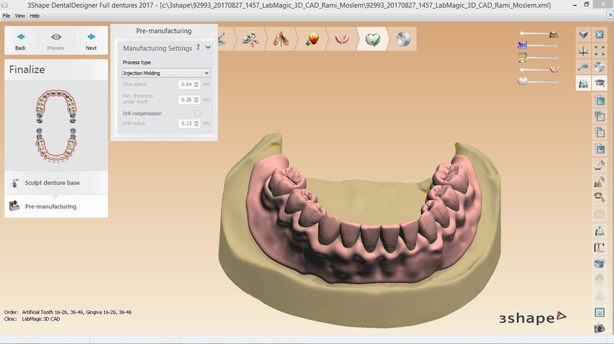 Digital Full Dentures for 3D Printing 3D Print 160495 Digital Full Dentures for 3D Printing 3D Print 160495