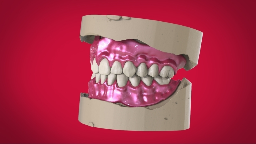 Digital Full Dentures for 3D Printing 3D Print 160496 Digital Full Dentures for 3D Printing 3D Print 160496