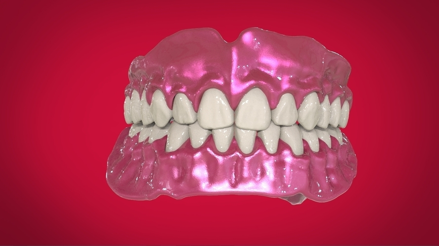 Digital Full Dentures for 3D Printing 3D Print 160498 Digital Full Dentures for 3D Printing 3D Print 160498