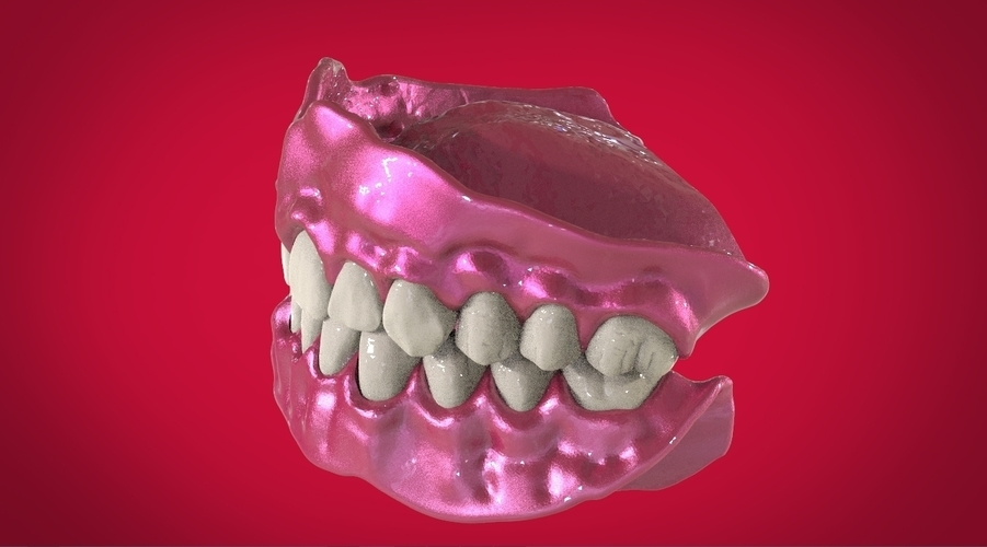 Digital Full Dentures for 3D Printing 3D Print 160499 Digital Full Dentures for 3D Printing 3D Print 160499