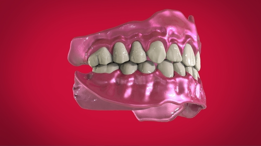 Digital Full Dentures for 3D Printing 3D Print 160500 Digital Full Dentures for 3D Printing 3D Print 160500