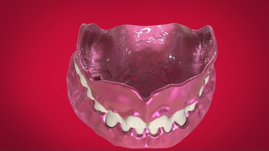 Digital Full Dentures for 3D Printing 3D Print 160501 Digital Full Dentures for 3D Printing 3D Print 160501