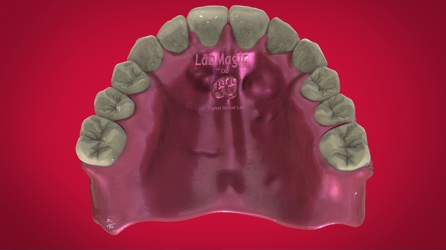 Digital Full Dentures for 3D Printing 3D Print 160504 Digital Full Dentures for 3D Printing 3D Print 160504