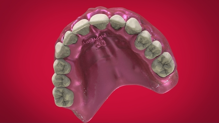 Digital Full Dentures for 3D Printing 3D Print 160505 Digital Full Dentures for 3D Printing 3D Print 160505