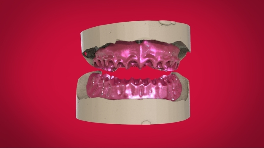 Digital Full Dentures for 3D Printing 3D Print 160506 Digital Full Dentures for 3D Printing 3D Print 160506