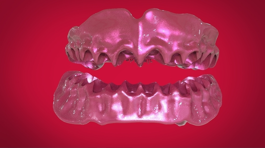 Digital Full Dentures for 3D Printing 3D Print 160507 Digital Full Dentures for 3D Printing 3D Print 160507