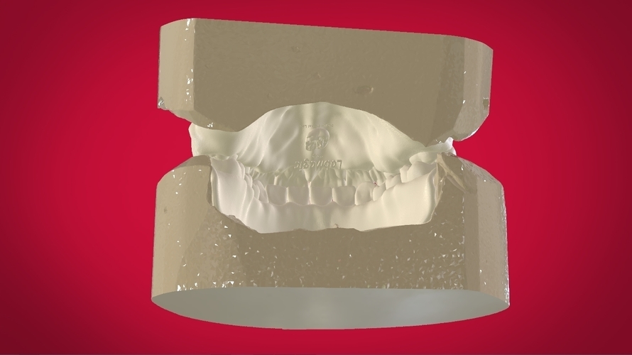 Digital Full Dentures for 3D Printing 3D Print 160509 Digital Full Dentures for 3D Printing 3D Print 160509