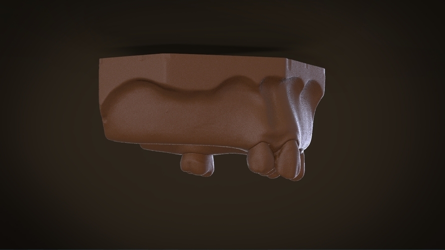 Digital Removable Partial Denture Framework 3D Print 160813 Digital Removable Partial Denture Framework 3D Print 160813