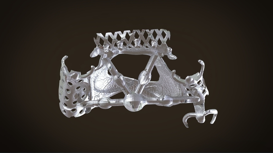 Digital Removable Partial Denture Framework 3D Print 160818 Digital Removable Partial Denture Framework 3D Print 160818