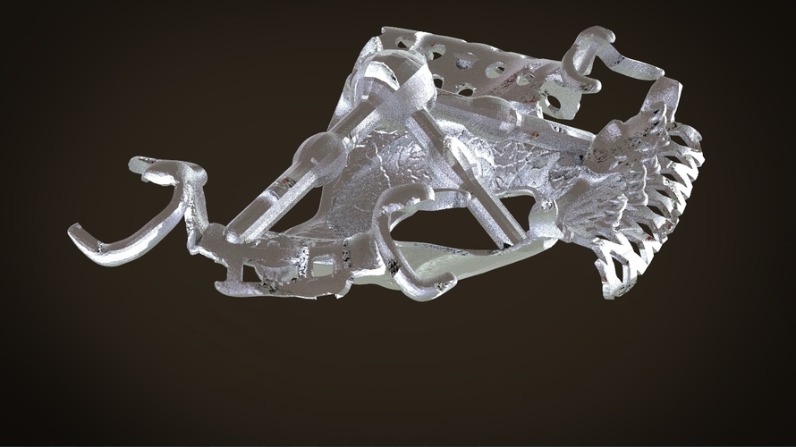 Digital Removable Partial Denture Framework 3D Print 160819 Digital Removable Partial Denture Framework 3D Print 160819