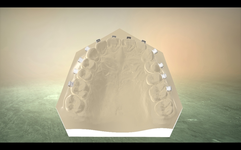 Digital Orthodontic Model with Brackets 3D Print 16584 Digital Orthodontic Model with Brackets 3D Print 16584