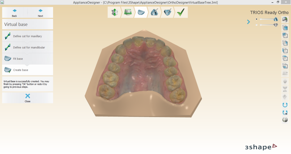 Digital Orthodontic Study Models with Virtual Bases 3D Print 191755 Digital Orthodontic Study Models with Virtual Bases 3D Print 191755