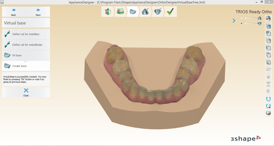 Digital Orthodontic Study Models with Virtual Bases 3D Print 191756 Digital Orthodontic Study Models with Virtual Bases 3D Print 191756