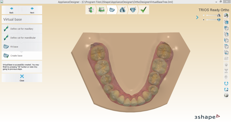 Digital Orthodontic Study Models with Virtual Bases 3D Print 191757 Digital Orthodontic Study Models with Virtual Bases 3D Print 191757