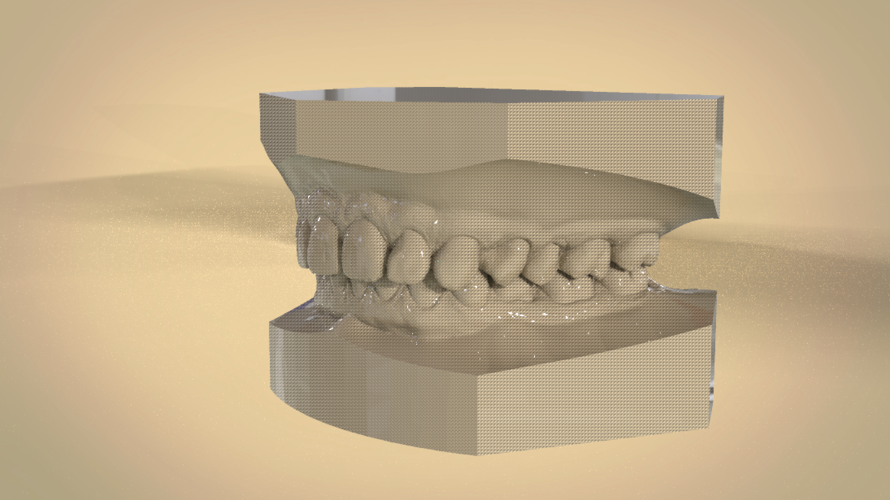 Digital Orthodontic Study Models with Virtual Bases 3D Print 191759 Digital Orthodontic Study Models with Virtual Bases 3D Print 191759