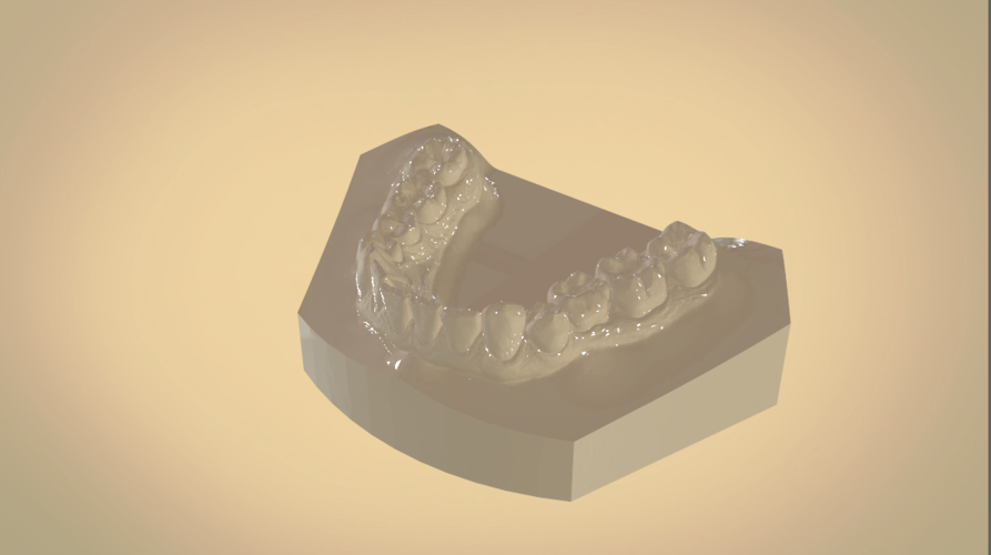 Digital Orthodontic Study Models with Virtual Bases 3D Print 191760 Digital Orthodontic Study Models with Virtual Bases 3D Print 191760