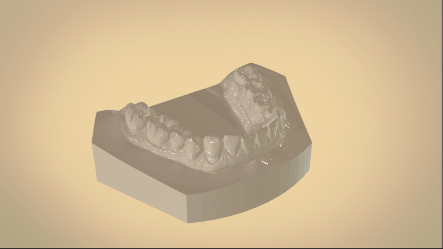 Digital Orthodontic Study Models with Virtual Bases 3D Print 191761 Digital Orthodontic Study Models with Virtual Bases 3D Print 191761