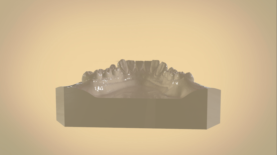 Digital Orthodontic Study Models with Virtual Bases 3D Print 191762 Digital Orthodontic Study Models with Virtual Bases 3D Print 191762