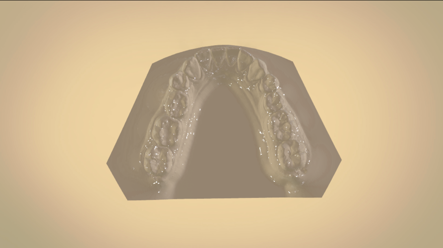 Digital Orthodontic Study Models with Virtual Bases 3D Print 191763 Digital Orthodontic Study Models with Virtual Bases 3D Print 191763