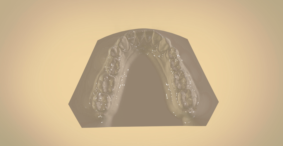 Digital Orthodontic Study Models with Virtual Bases 3D Print 191764 Digital Orthodontic Study Models with Virtual Bases 3D Print 191764