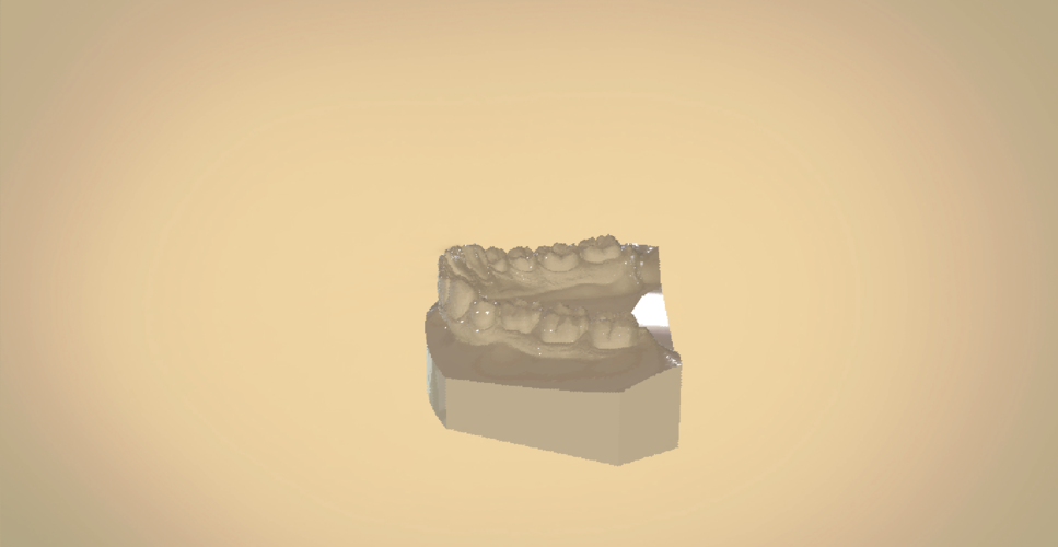 Digital Orthodontic Study Models with Virtual Bases 3D Print 191765 Digital Orthodontic Study Models with Virtual Bases 3D Print 191765