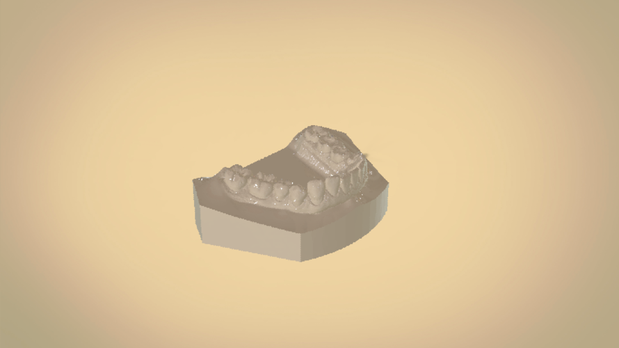 Digital Orthodontic Study Models with Virtual Bases 3D Print 191766 Digital Orthodontic Study Models with Virtual Bases 3D Print 191766