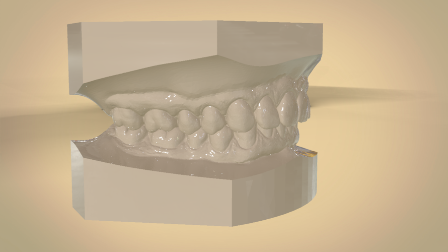 Digital Orthodontic Study Models with Virtual Bases 3D Print 191768 Digital Orthodontic Study Models with Virtual Bases 3D Print 191768