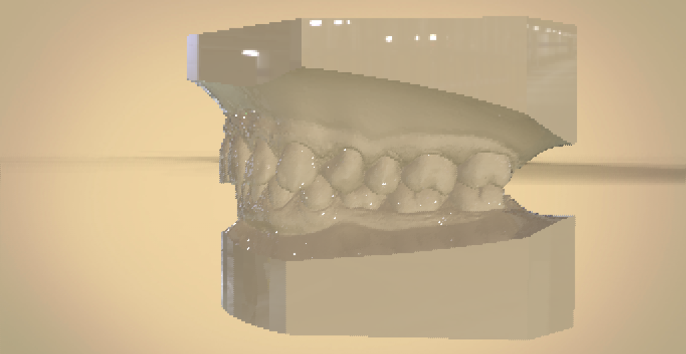 Digital Orthodontic Study Models with Virtual Bases 3D Print 191770 Digital Orthodontic Study Models with Virtual Bases 3D Print 191770