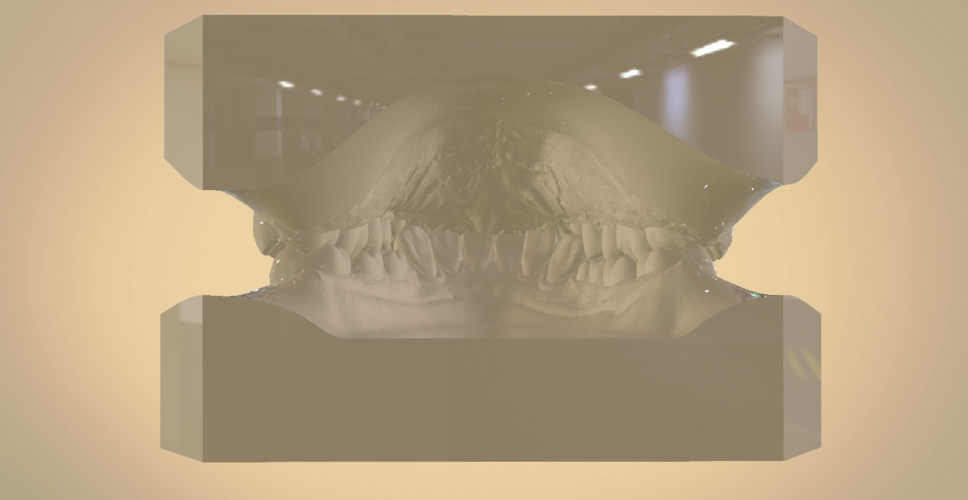Digital Orthodontic Study Models with Virtual Bases 3D Print 191771 Digital Orthodontic Study Models with Virtual Bases 3D Print 191771