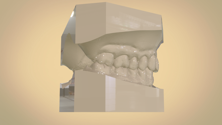Digital Orthodontic Study Models with Virtual Bases 3D Print 191772 Digital Orthodontic Study Models with Virtual Bases 3D Print 191772